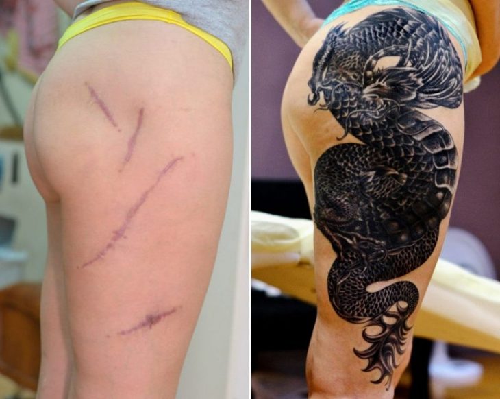 30 татуировок, благодаря которым шрамы и родинки выглядят лучше