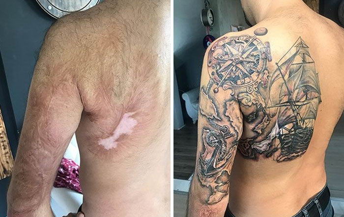 30 татуировок, благодаря которым шрамы и родинки выглядят лучше