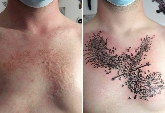 30 Tattoos That Make Scars and Moles Look Better